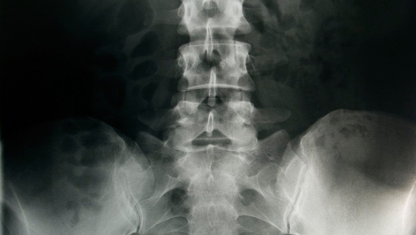 Santé de la colonne vertébrale et des articulations